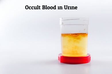 Occult Blood in Urine