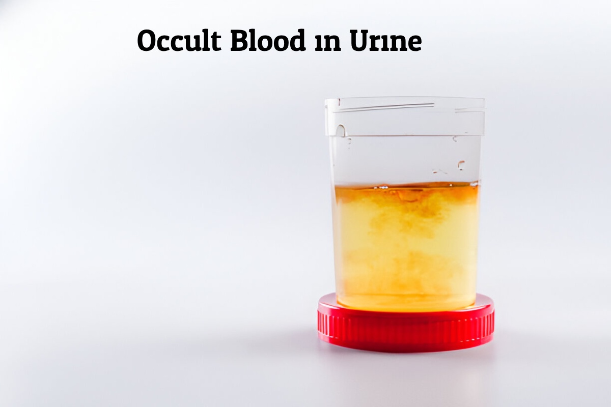 occult-blood-in-urine-what-should-i-do-next
